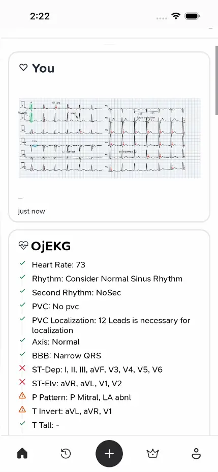 EKG Analysis App
