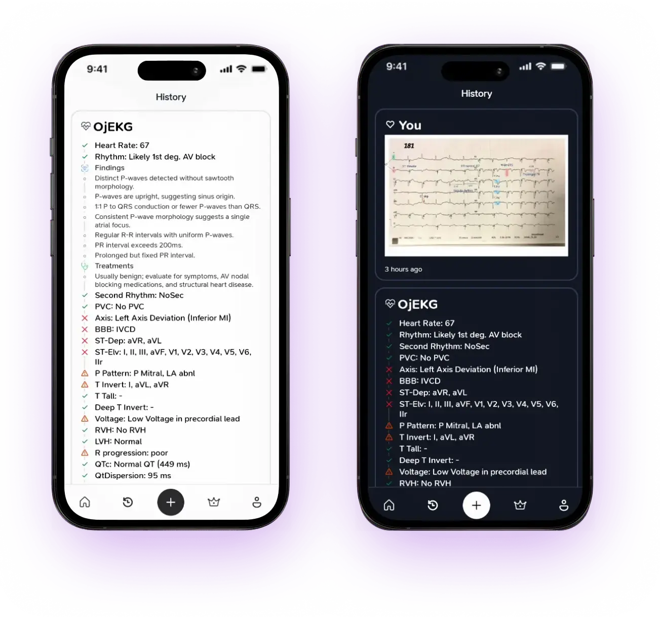 OjEKG Light & Dark Theme